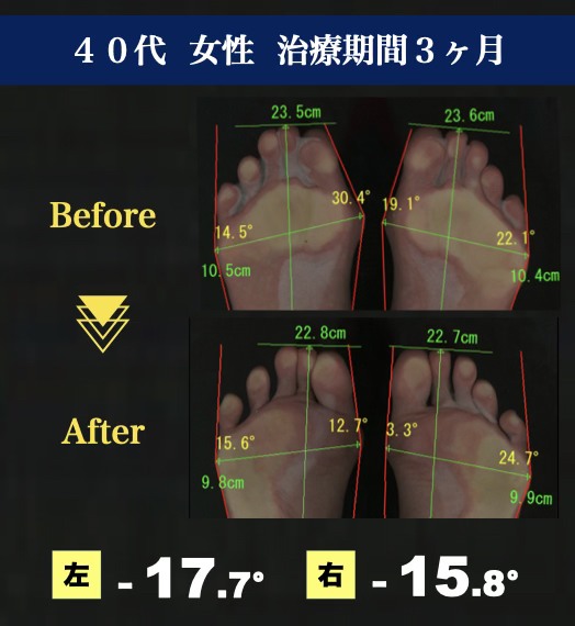 40代女性治療期間3ヶ月