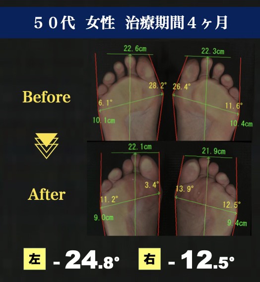 50代女性 治療期間4ヶ月