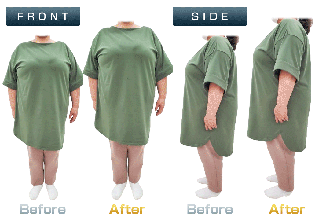 ビフォーアフター