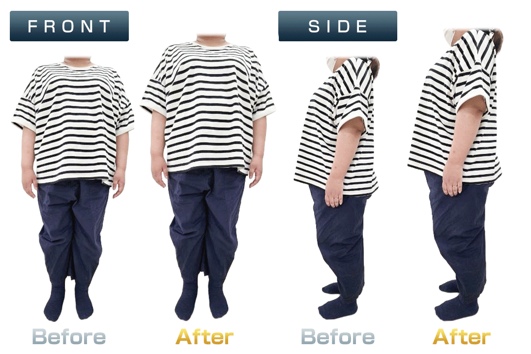 ビフォーアフター