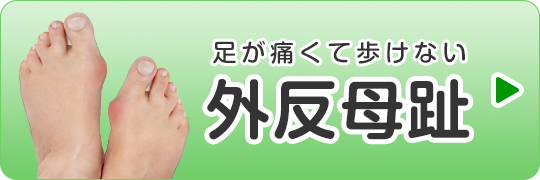 外反母趾