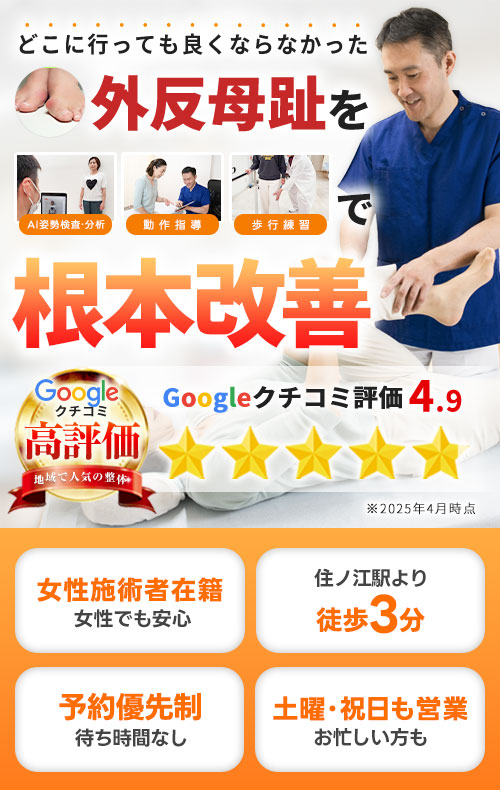 外反母趾